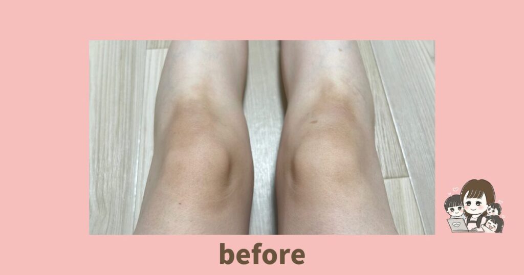 【膝の黒ずみが消えた?】ぽろぽろとれる杏ジェルでトーンアップ!ママの膝ケア体験レビュー